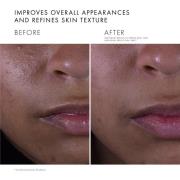 SkinCeuticals Silymarin CF Antioxiderend Serum met Vitamine C en Salic...