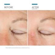 SkinCeuticals A.G.E. Advanced Eye voor Donkere Kringen en Rimpels 15ml