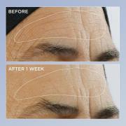 Perricone MD High Potency Retinol Renewal Serum 2oz FG