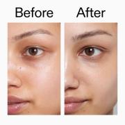 The INKEY List Skin Reset Bundle