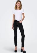 NU 20% KORTING: Only High-waist jeans ONLROYAL HW SK FLY BTN GUA DK BL...